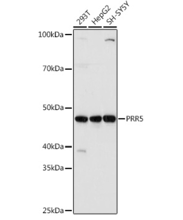 PRR5 Rabbit Polyclonal Antibody
