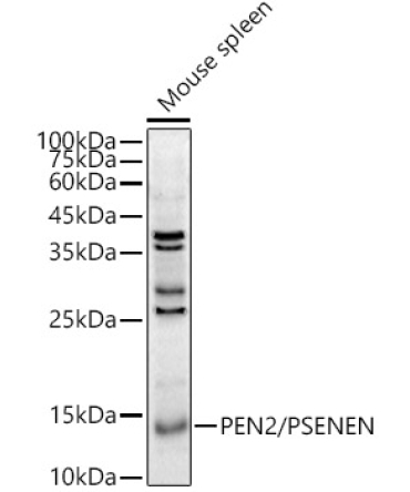PEN2/PSENEN Rabbit Polyclonal Antibody