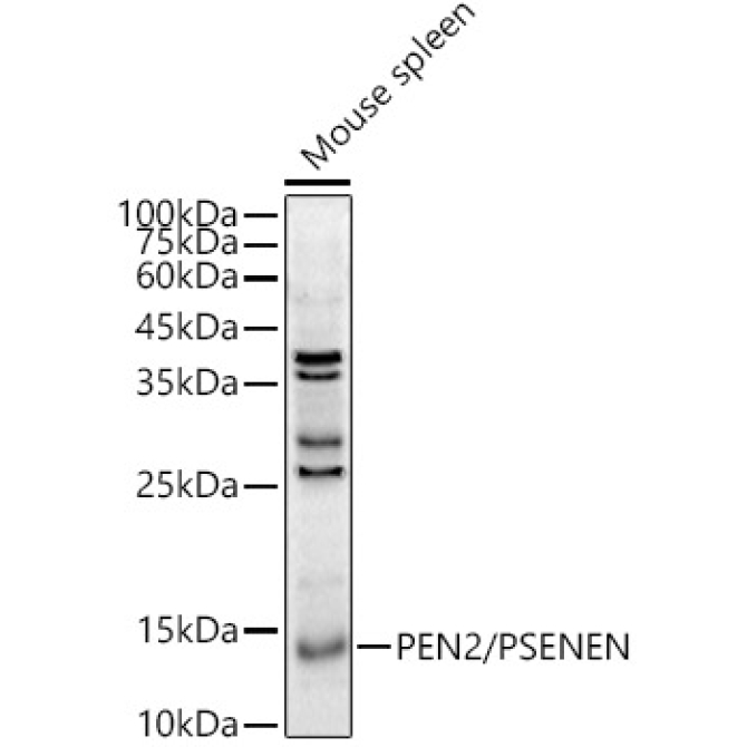 PEN2/PSENEN Rabbit Polyclonal Antibody