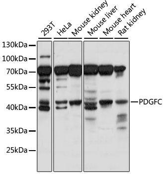 PDGFC Rabbit Polyclonal Antibody