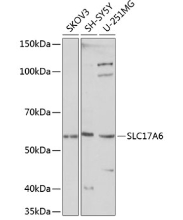 SLC17A6 Rabbit Polyclonal Antibody
