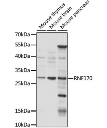 RNF170 Rabbit Polyclonal Antibody