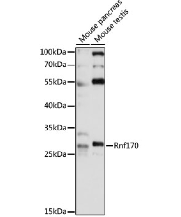 Rnf170 Rabbit Polyclonal Antibody