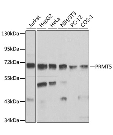 PRMT5 Rabbit Polyclonal Antibody