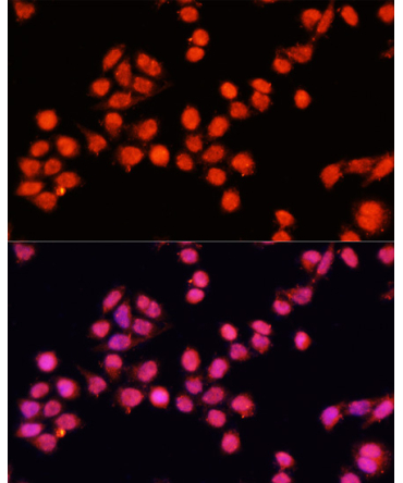 SLC24A5 Rabbit Polyclonal Antibody