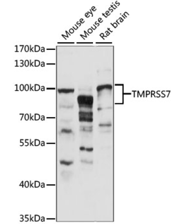 TMPRSS7 Rabbit Polyclonal Antibody