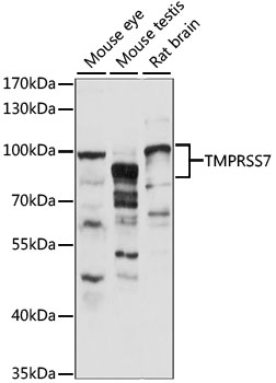 TMPRSS7 Rabbit Polyclonal Antibody