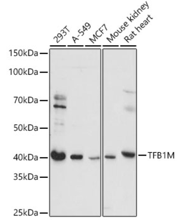 TFB1M Rabbit Polyclonal Antibody