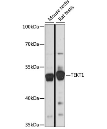 TEKT1 Rabbit Polyclonal Antibody