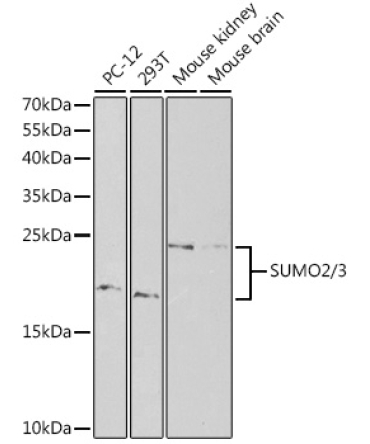 SUMO2/3 Rabbit Polyclonal Antibody