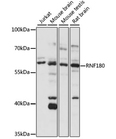 RNF180 Rabbit Polyclonal Antibody