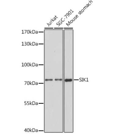 SIK1 Rabbit Polyclonal Antibody