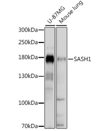 SASH1 Rabbit Polyclonal Antibody