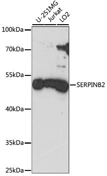 SERPINB2 Rabbit Polyclonal Antibody