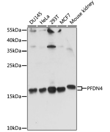 PFDN4 Rabbit Polyclonal Antibody