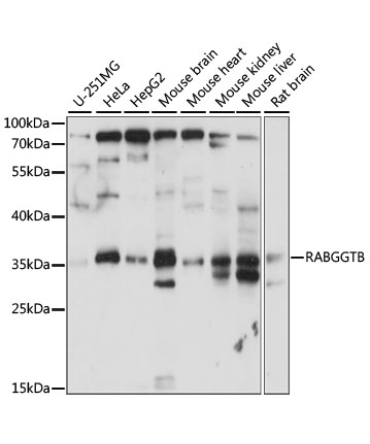 RABGGTB Rabbit Polyclonal Antibody