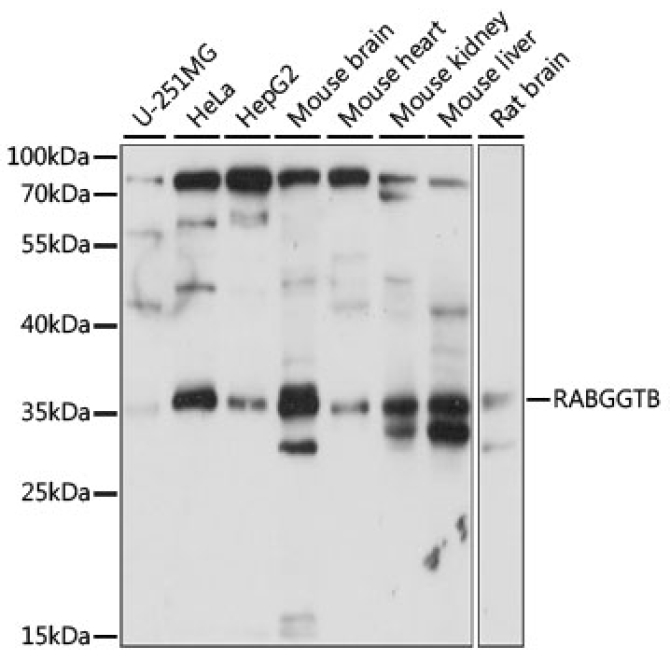 RABGGTB Rabbit Polyclonal Antibody