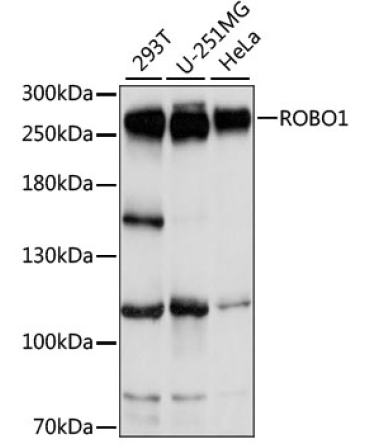 ROBO1 Rabbit Polyclonal Antibody