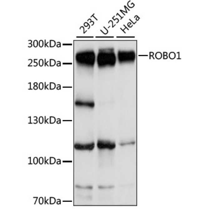 ROBO1 Rabbit Polyclonal Antibody