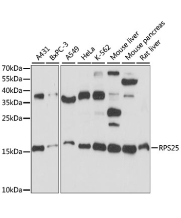 RPS25 Rabbit Polyclonal Antibody