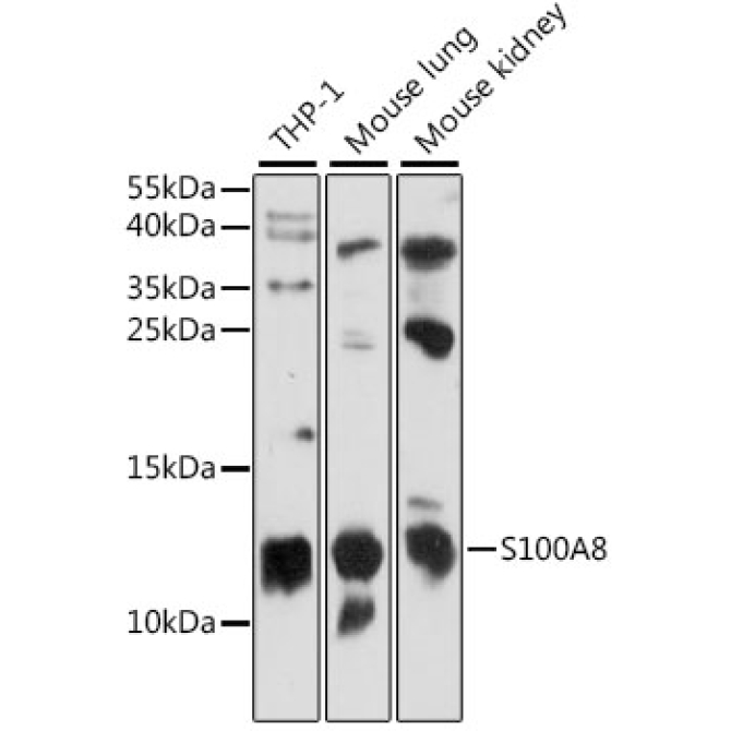 S100A8 Rabbit Polyclonal Antibody