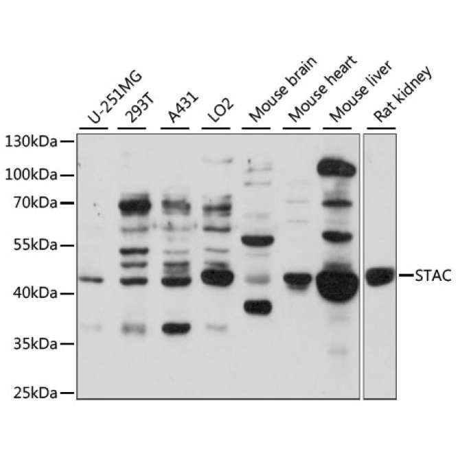 STAC Rabbit Polyclonal Antibody