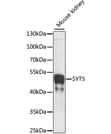 SYT5 Rabbit Polyclonal Antibody
