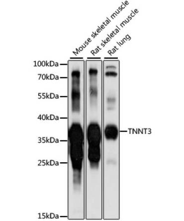 TNNT3 Rabbit Polyclonal Antibody