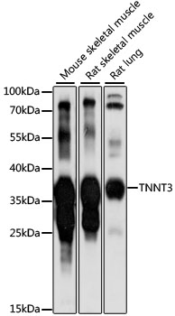 TNNT3 Rabbit Polyclonal Antibody