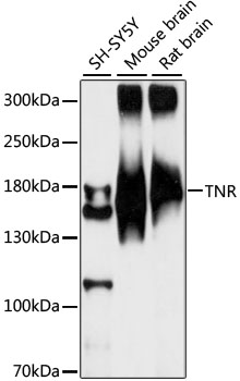 TNR Rabbit Polyclonal Antibody