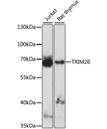 TRIM26 Rabbit Polyclonal Antibody