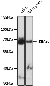 TRIM26 Rabbit Polyclonal Antibody