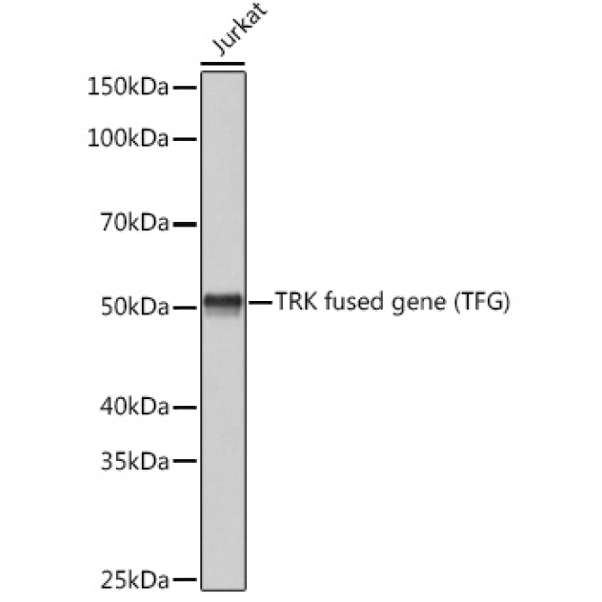 TRK fused gene (TFG) Rabbit Monoclonal Antibody