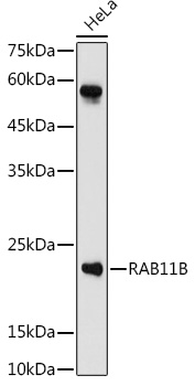 RAB11B Rabbit Polyclonal Antibody