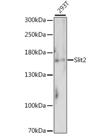 Slit2 Rabbit Polyclonal Antibody