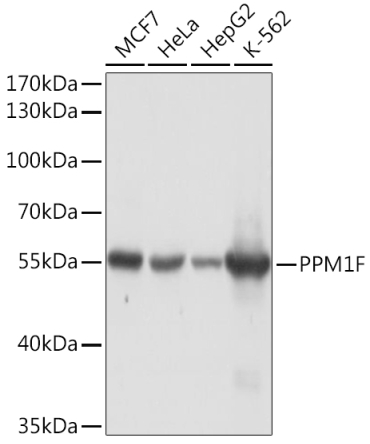 PPM1F Rabbit Polyclonal Antibody