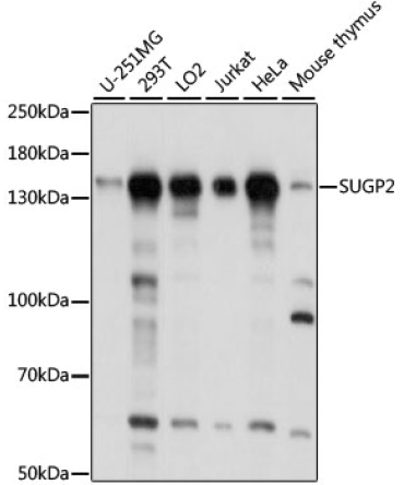 SUGP2 Rabbit Polyclonal Antibody