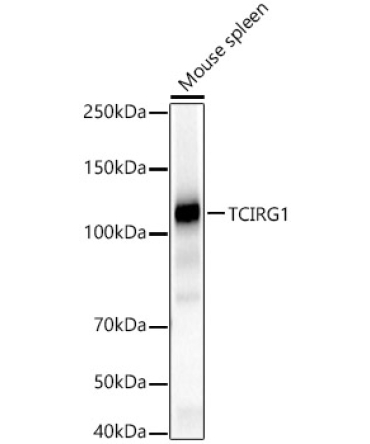 TCIRG1 Rabbit Polyclonal Antibody