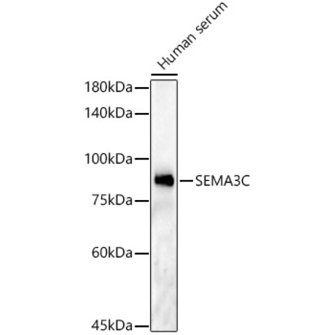 SEMA3C Rabbit Polyclonal Antibody