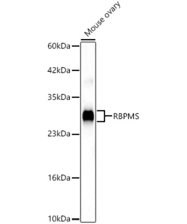 RBPMS Rabbit Polyclonal Antibody