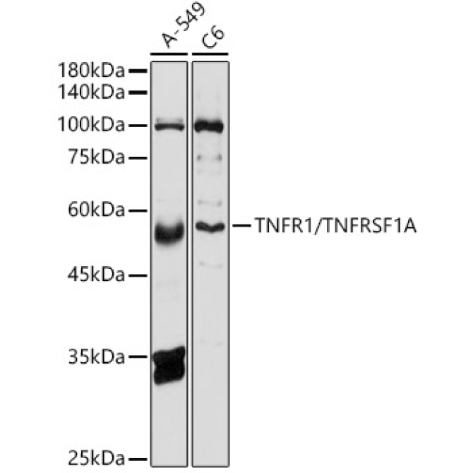 TNFR1/TNFRSF1A Rabbit Polyclonal Antibody