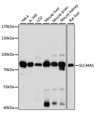 SLC44A1 Rabbit Polyclonal Antibody
