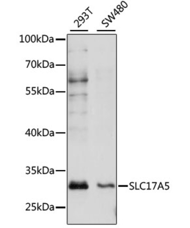 SLC17A5 Rabbit Polyclonal Antibody