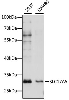 SLC17A5 Rabbit Polyclonal Antibody