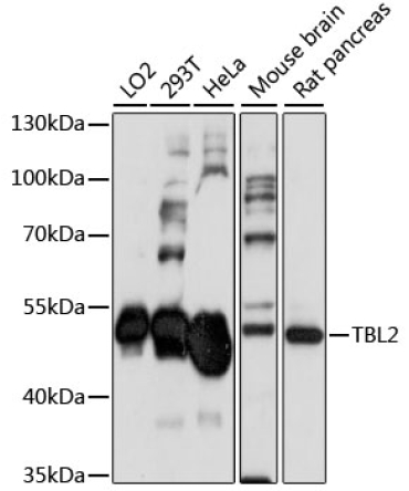 TBL2 Rabbit Polyclonal Antibody