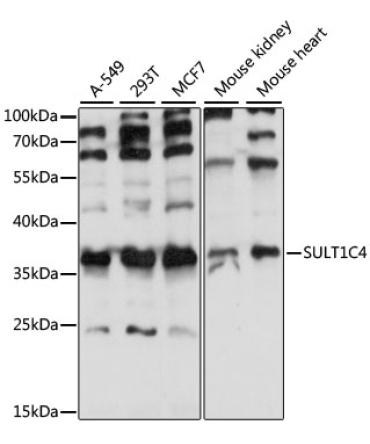 SULT1C4 Rabbit Polyclonal Antibody