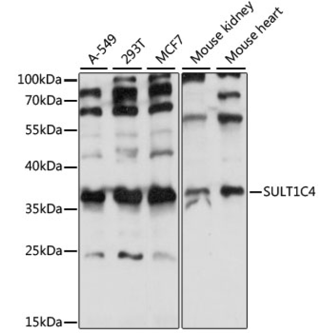 SULT1C4 Rabbit Polyclonal Antibody