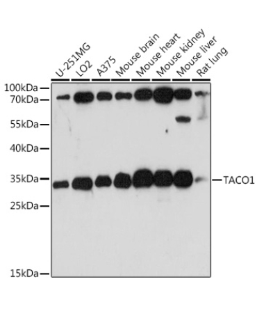 TACO1 Rabbit Polyclonal Antibody
