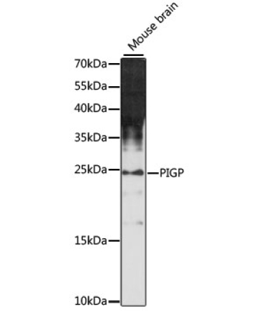 PIGP Rabbit Polyclonal Antibody