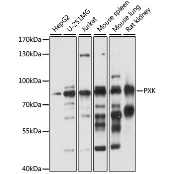PXK Rabbit Polyclonal Antibody